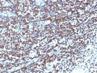 Formalin-fixed, paraffin embedded human tonsil sections stained with 100 ul anti-Histone H1 (clone HH1/957) at 1:100. HIER epitope retrieval prior to staining was performed in 10mM Citrate, pH 6.0.